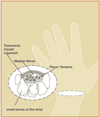 Figure of the Transverse Carpal Tunnel Ligament